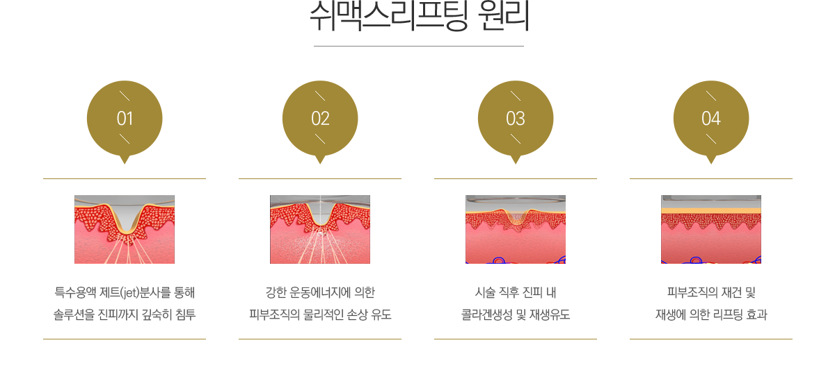 ���ƽ������� ����