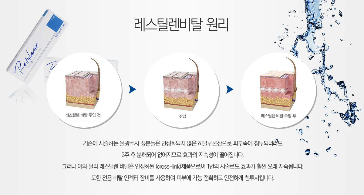 ����ƿ����Ż ����