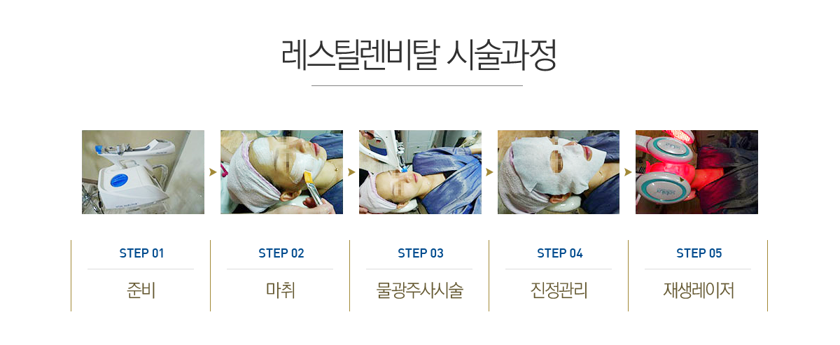 ����ƿ����Ż �ü�����