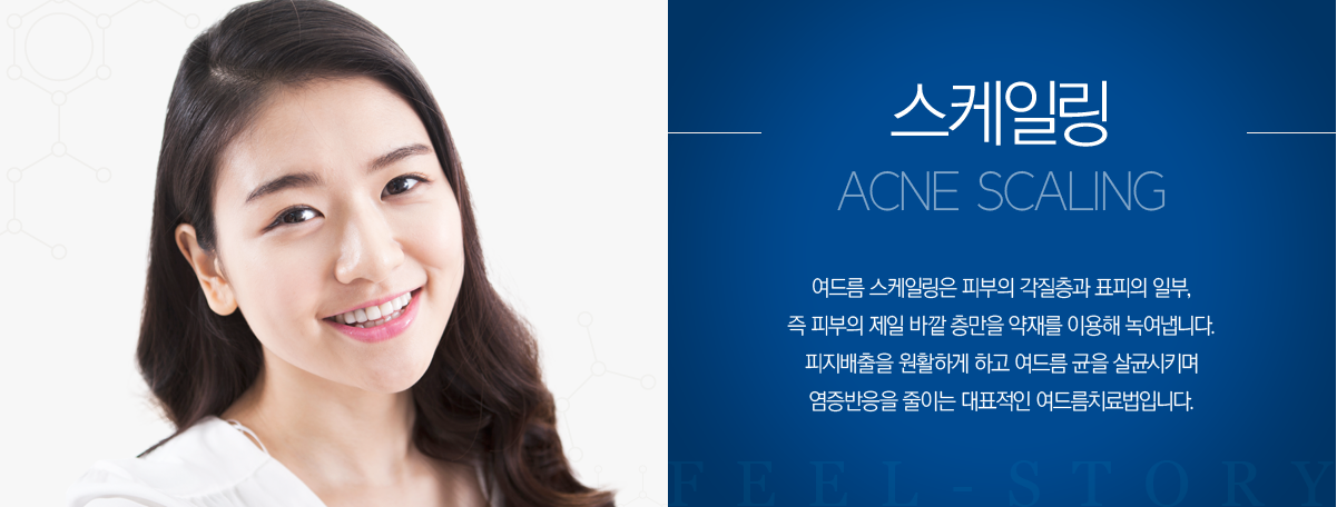 �����ϸ�