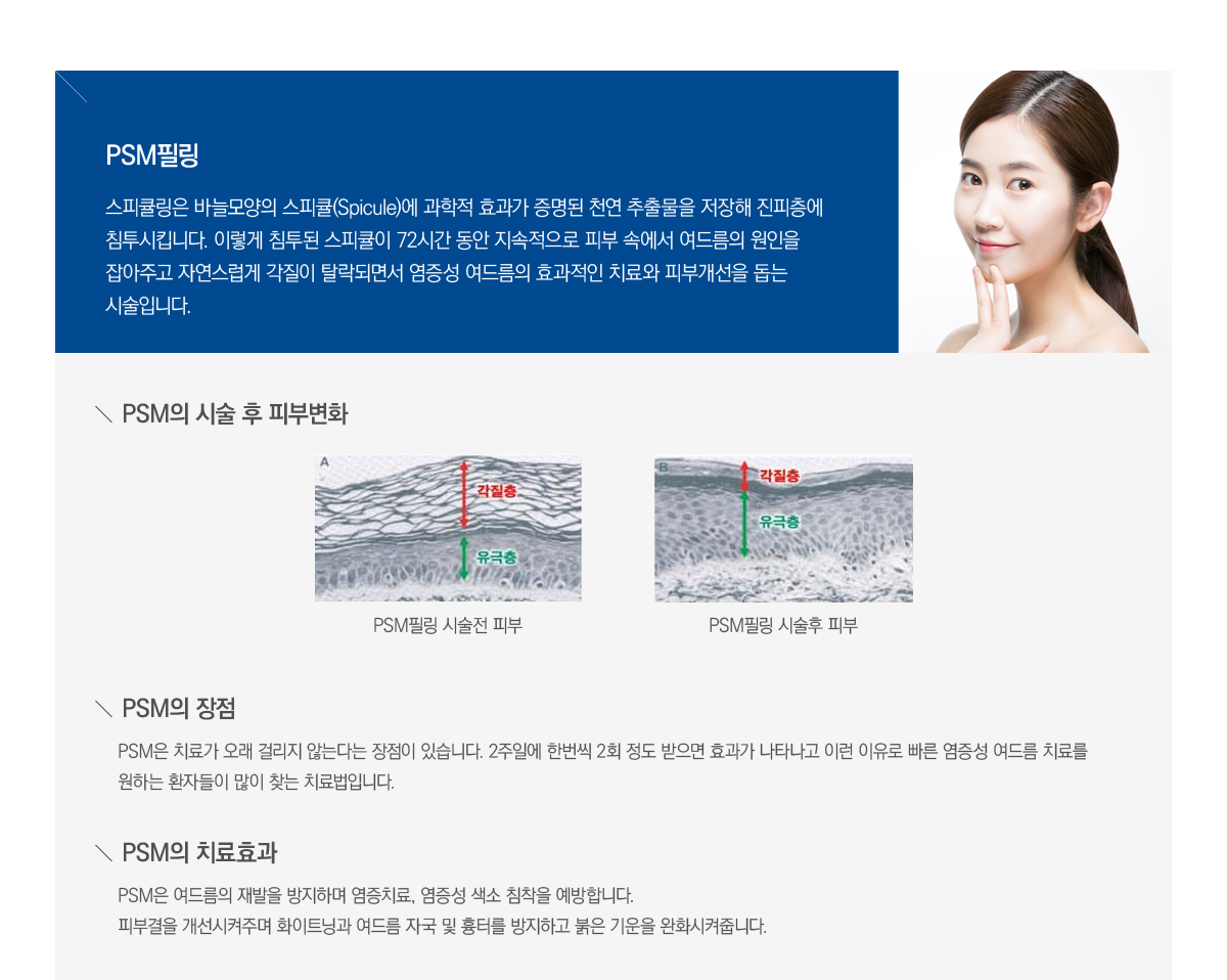 ���帧�ʸ� ���� - PSM�ʸ�