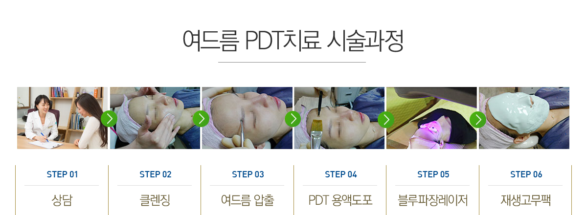 ���帧 PDTġ�� �ü�����