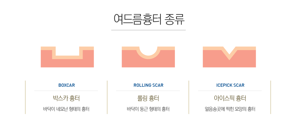 ���帧 ���� ����