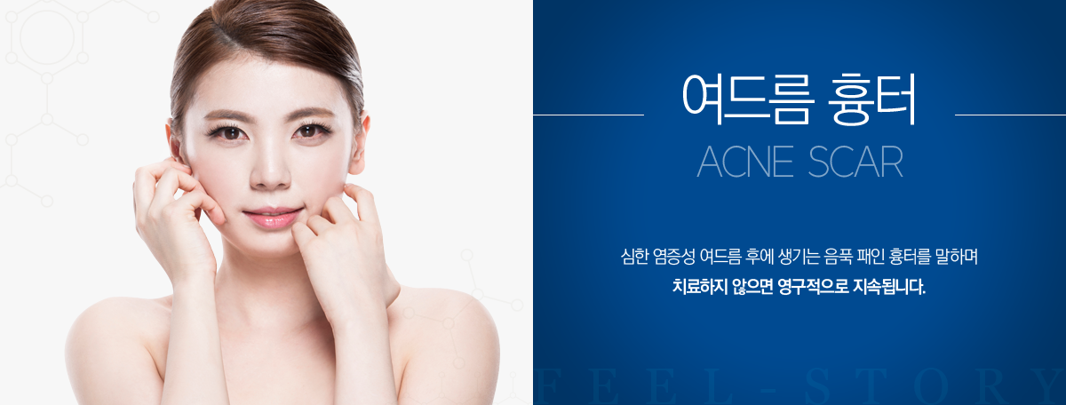 ���帧 ����