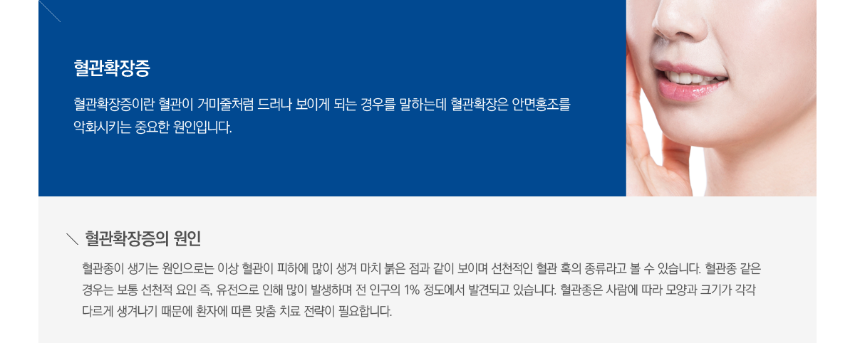 ����Ȯ������ ����