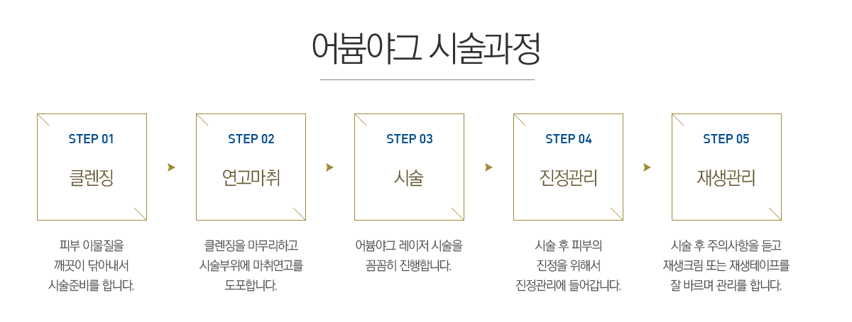 ���߱� �ü�����