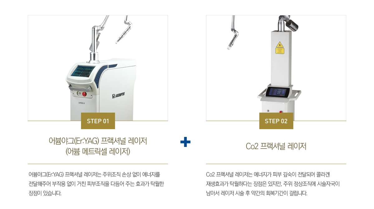 ����(2-Setp) �����ų� ���