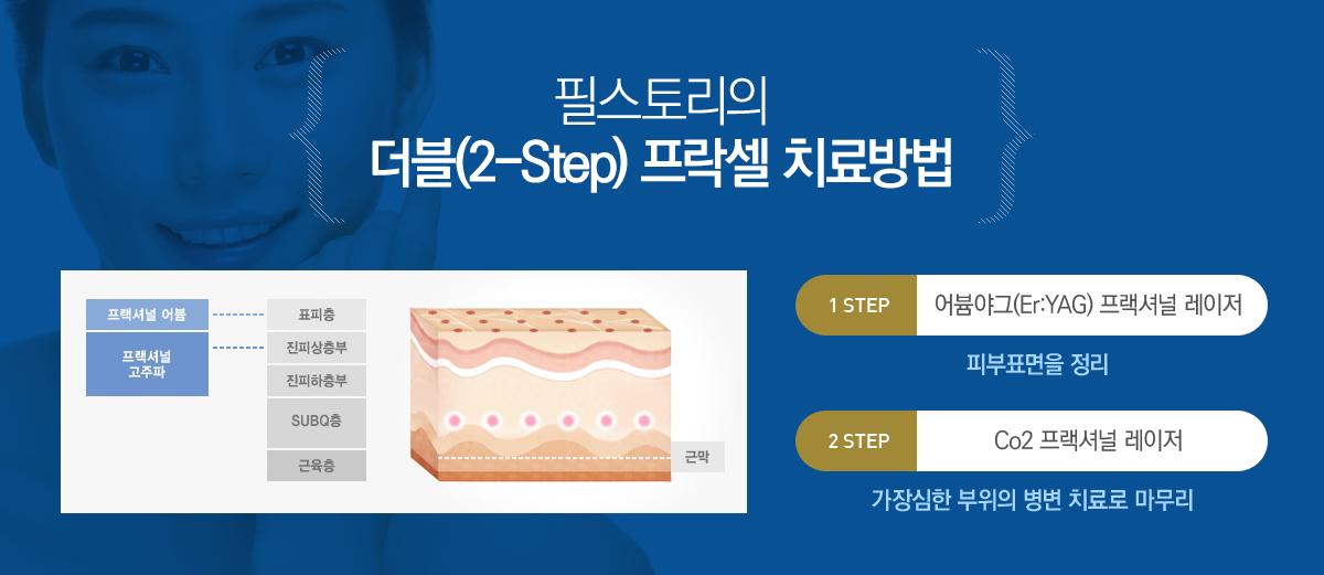 ����(2-Setp) �����ų� ġ����