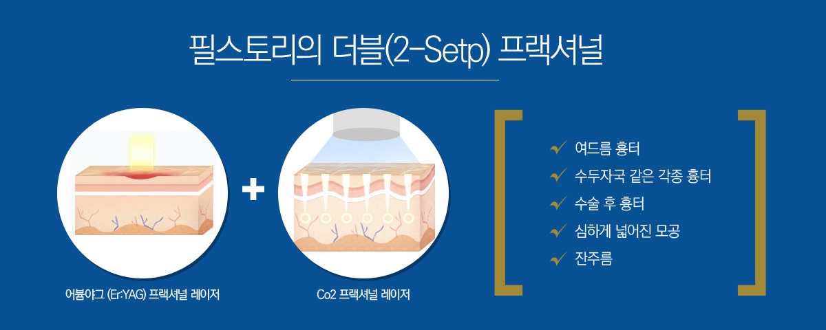 �ʽ��丮�� ����(2-Setp) �����ų�