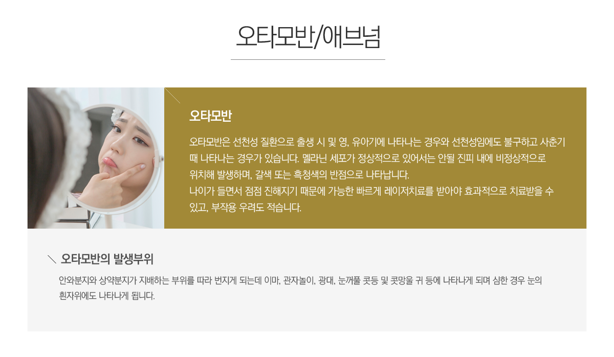 ��Ÿ��ݰ� �߻�����