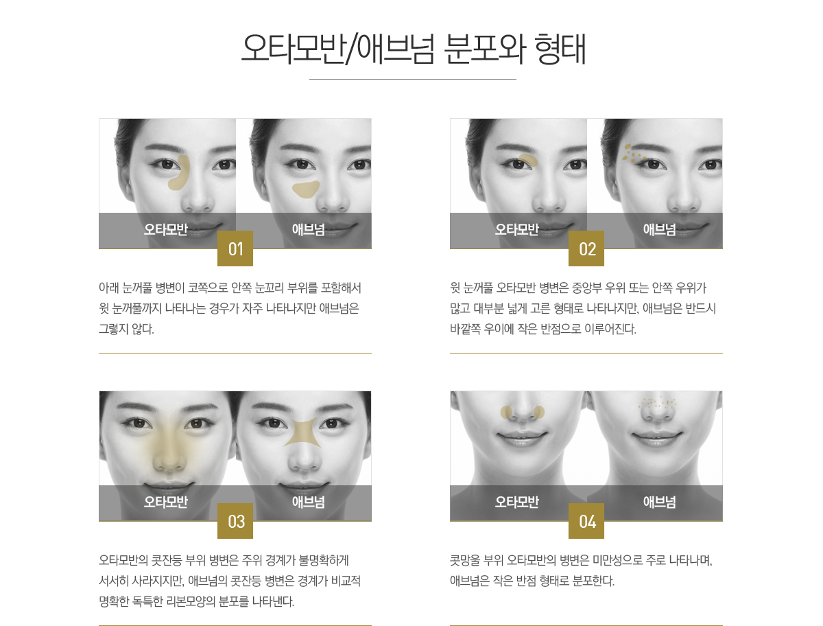 ��Ÿ���/�ֺ�� ������ ����