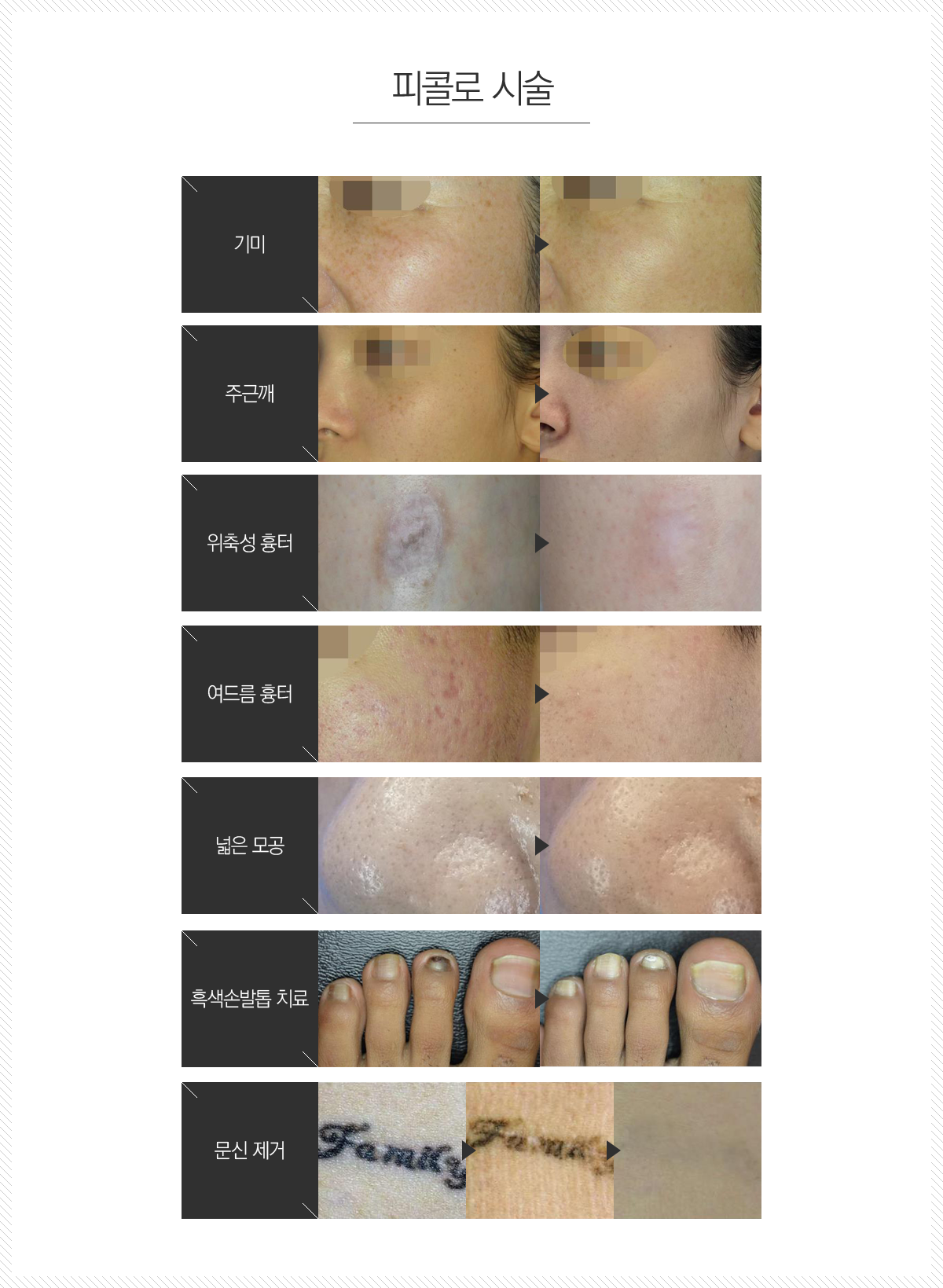 ���ݷ� �ü�